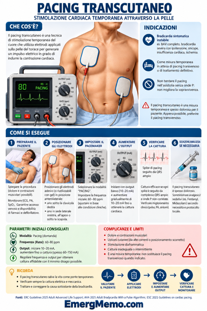 Infografica sul pacing transcutaneo: indicazioni, posizionamento degli elettrodi, impostazioni e monitoraggio.